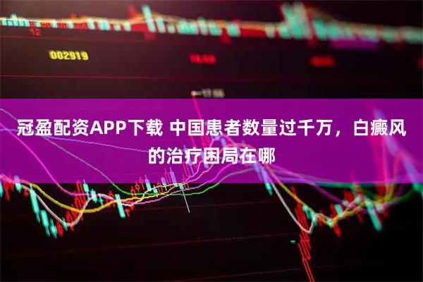 冠盈配资APP下载 中国患者数量过千万，白癜风的治疗困局在哪